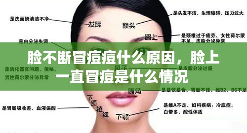脸不断冒痘痘什么原因，脸上一直冒痘是什么情况 