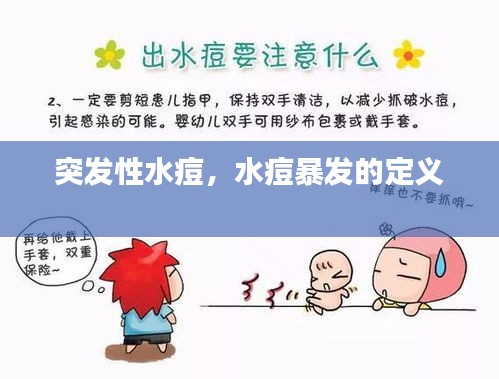 突发性水痘，水痘暴发的定义 