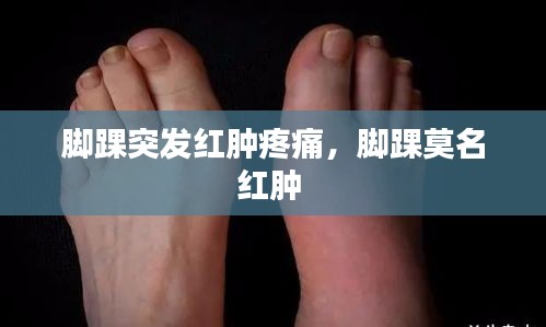 脚踝突发红肿疼痛，脚踝莫名红肿 